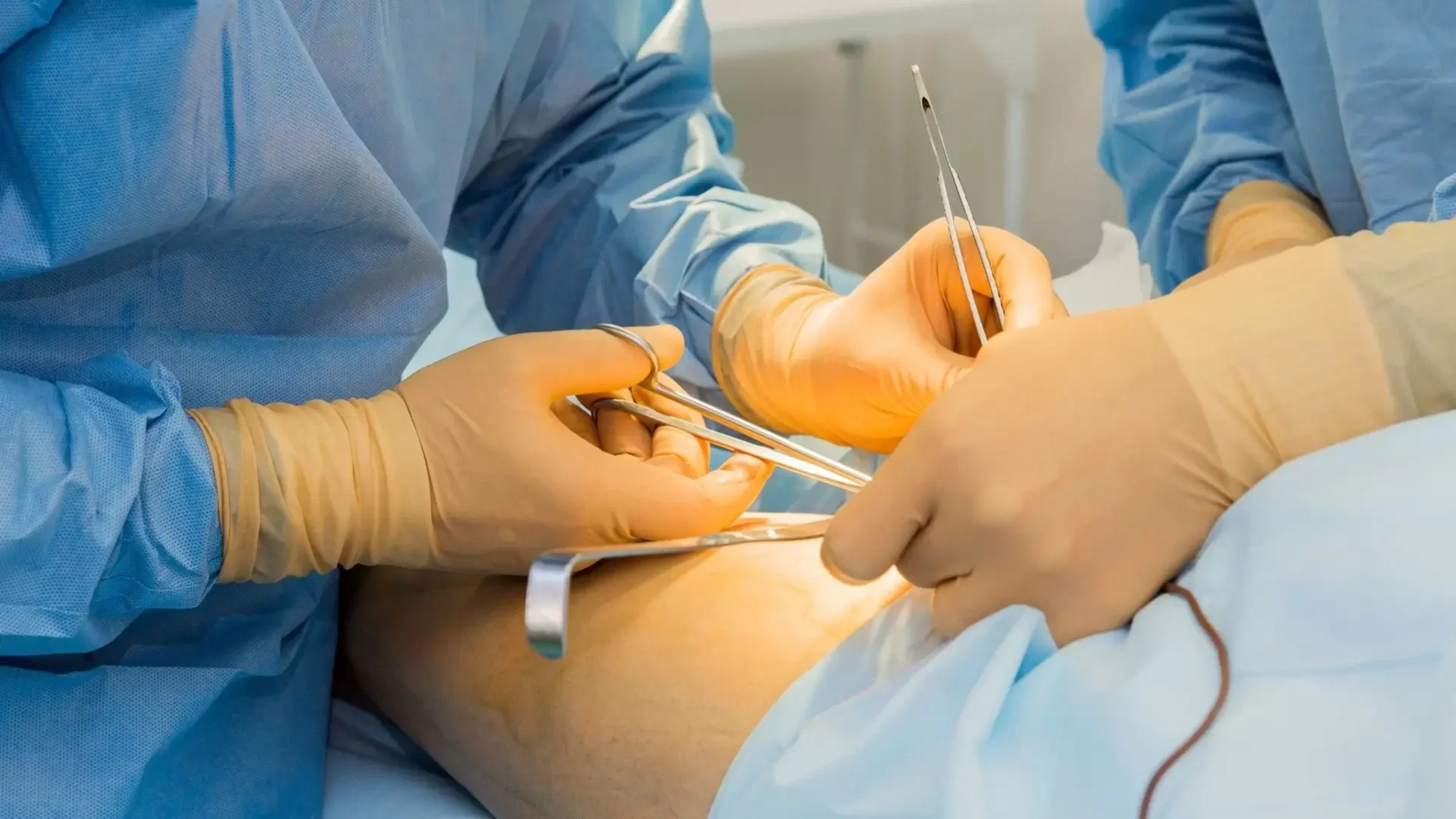 Tüp Mide Ameliyatı Öncesi Hazırlık Nasıl Olmalı?