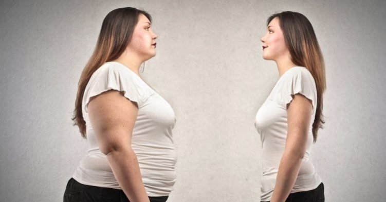 Tüp Mide Ameliyatı