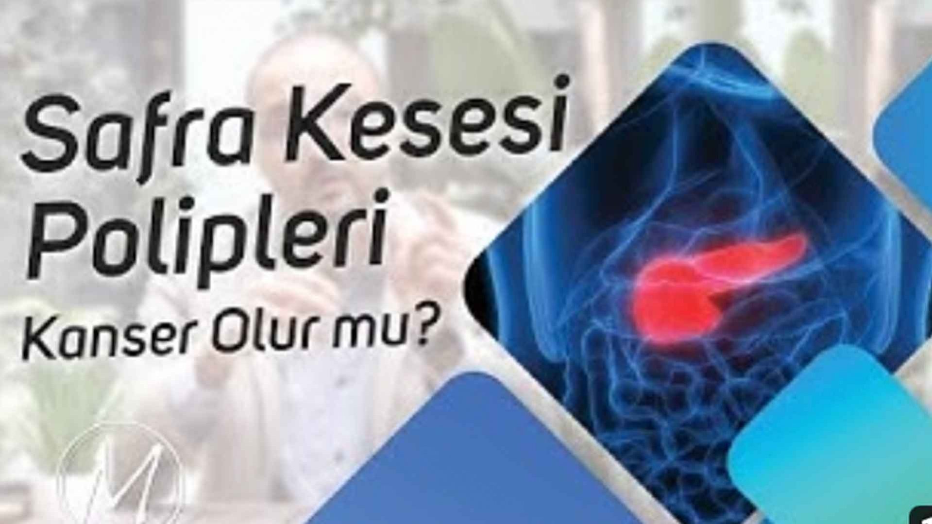Safra Kesesi Polipleri (Kanser Olur mu?) Op.Dr. Muzaffer Önder Öner